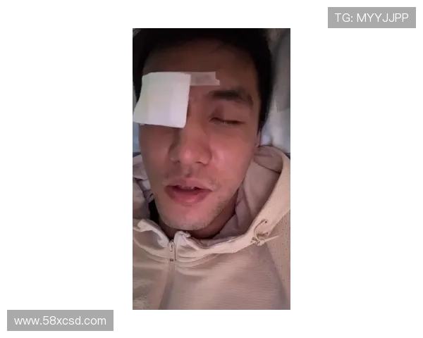 [CBA]CBA球员郭艾伦训练中右眼受伤.